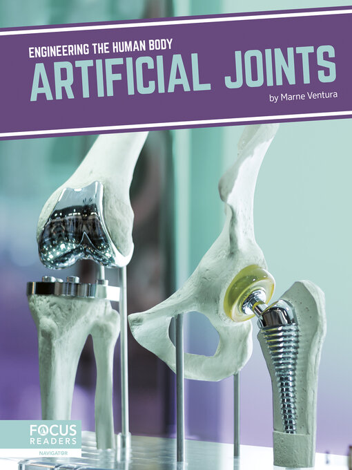 Title details for Artificial Joints by Marne Ventura - Wait list